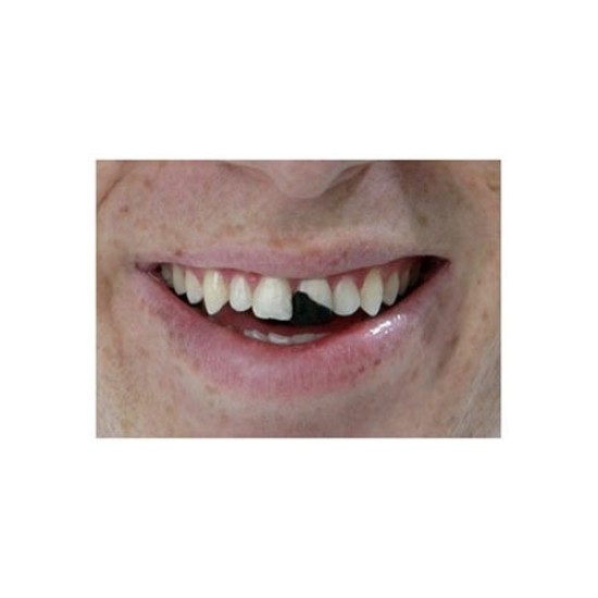 Dente Quebrado Lóide Luxo Os Debilóides Adulto